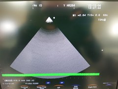 超音波診断装置｜F37｜日立製作所の写真19枚目