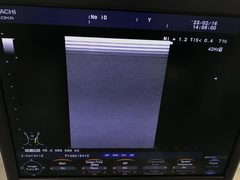 超音波診断装置｜F37｜日立製作所の写真19枚目