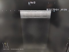 超音波診断装置｜ARIETTA 60｜日立製作所の写真19枚目