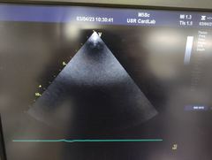超音波診断装置(カラードプラ)ＬＣＤ｜Vivid E9 with XDclear｜GEヘルスケアの写真19枚目