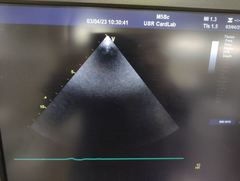 Ultrasound system｜Vivid E9 with XDclear｜GE Healthcare photo19