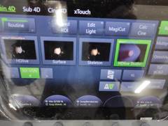 4D超音波診断装置（カラードプラ）｜Voluson E10｜GEヘルスケアの写真19枚目