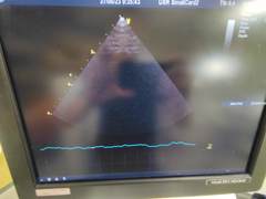 超音波診断装置(カラードプラ)ＬＣＤ｜Vivid E9 with XDclear｜GEヘルスケアの写真19枚目