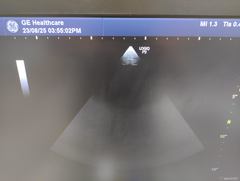 超音波診断装置｜LOGIQ P9｜GEヘルスケアの写真19枚目