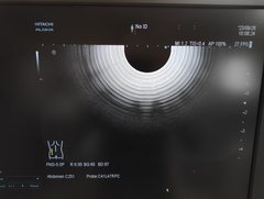 超音波診断装置｜ARIETTA S70｜日立製作所の写真19枚目