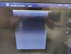 超音波診断装置｜LOGIQ S8 XDclear｜GEヘルスケアの写真17枚目