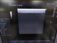 超音波診断装置（カラードプラ）｜LOGIQ P6｜GEヘルスケアの写真19枚目