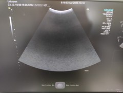 超音波診断装置｜ACUSON S2000 HELX Evolution｜持田シーメンスメディカルの写真19枚目