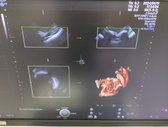 Ultrasound system(Color)｜Voluson E10｜GE Healthcare photo19