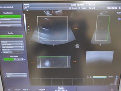 Ultrasound system(Color)｜Voluson S8｜GE Healthcare photo16