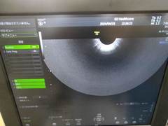 Ultrasound system(Color)｜Voluson P8｜GE Healthcare photo19