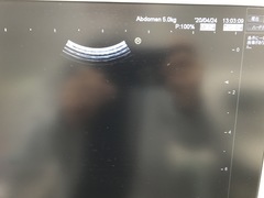 Ultrasound system(Color)｜HI VISION Avius｜Hitachi photo17