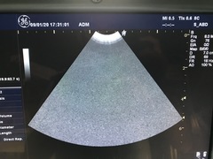 Ultrasound system(Color)｜LOGIQ P5｜GE Healthcare photo17