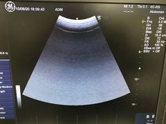 Ultrasound system(Color)｜LOGIQ e Expert｜GE Healthcare photo18