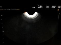 Ultrasound system｜SONOACE R7｜Samsung Medison photo2