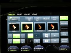 Ultrasound system(Color)｜Voluson E8｜GE Healthcare photo12