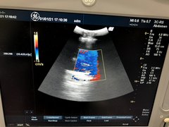 Ultrasound system｜LOGIQ BOOK XP  Enhanced｜GE Healthcare photo2