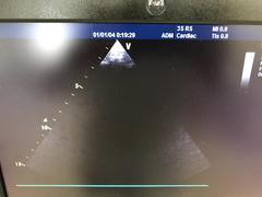 Ultrasound system(Color)｜Vivid S5｜GE Healthcare photo3