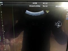 Ultrasound system(Color)｜Voluson P8｜GE Healthcare photo14