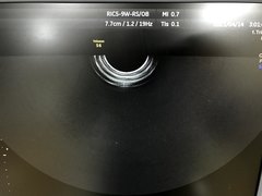 Ultrasound system(Color)｜Voluson S6｜GE Healthcare photo15