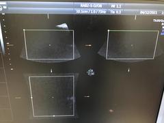 Ultrasound system(Color)｜Voluson E6｜GE Healthcare photo14