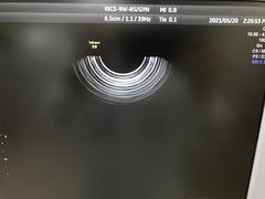 Ultrasound system(Color)｜Voluson S8｜GE Healthcare photo12