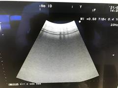 Ultrasound system｜F37｜Hitachi photo17