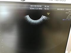 Ultrasound system(Color)｜Voluson S6｜GE Healthcare photo16