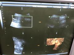 Ultrasound system(Color)｜Voluson 730 Expert｜GE Healthcare photo16