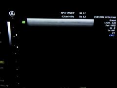 Ultrasound system(Color)｜VOLUSON 730PRO｜GE Healthcare photo20