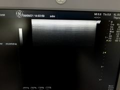 Ultrasound system｜LOGIQ BOOK XP  Enhanced｜GE Healthcare photo2