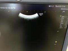 Ultrasound system｜LOGIQ E9｜GE Healthcare photo17