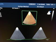 Ultrasound system｜iE33｜Philips photo20