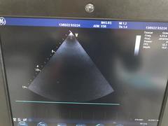Ultrasound system(Color)｜Vivid S6｜GE Healthcare photo20