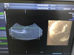 Ultrasound system(Color)｜Voluson P8｜GE Healthcare photo20
