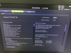 4D超音波診断装置（カラードプラ）｜Voluson E10｜GEヘルスケアの写真20枚目