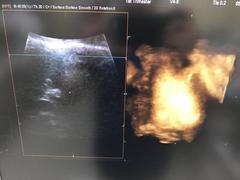 Ultrasound system｜ACCUVIX-XG｜Samsung Medison photo20