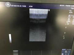 超音波診断装置｜LOGIQ e Premium｜GEヘルスケアの写真20枚目