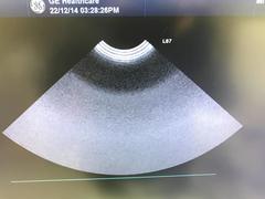超音波診断装置｜LOGIQ S7 with XDclear｜GEヘルスケアの写真20枚目
