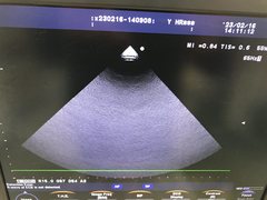 超音波診断装置｜F37｜日立製作所の写真20枚目