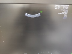 4D超音波診断装置（カラードプラ）｜Voluson E10｜GEヘルスケアの写真20枚目