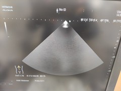 超音波診断装置｜ARIETTA 60｜日立製作所の写真20枚目