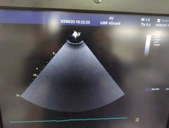 超音波診断装置(カラードプラ)ＬＣＤ｜Vivid E9 with XDclear｜GEヘルスケアの写真20枚目