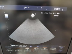 Ultrasound system｜F37｜Hitachi photo20