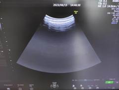 4D超音波診断装置（カラードプラ）｜Voluson S6｜GEヘルスケアの写真11枚目