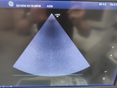 超音波診断装置｜LOGIQ S8 XDclear｜GEヘルスケアの写真18枚目