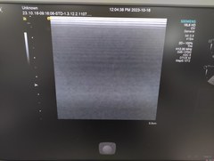 超音波診断装置｜ACUSON S2000 HELX Evolution｜持田シーメンスメディカルの写真20枚目