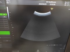 Ultrasound system(Color)｜Voluson P8｜GE Healthcare photo20
