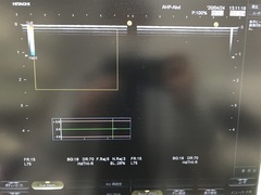 Ultrasound system(Color)｜HI VISION Avius｜Hitachi photo18
