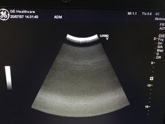 Ultrasound System｜LOGIQ V5｜GE Healthcare photo14